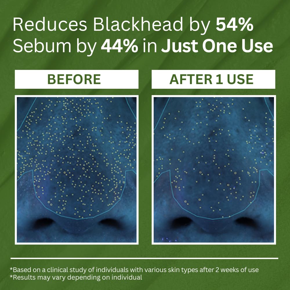 Clinclii™ Pore Bliss Bubble Mask - Deep Cleansing & Purifying