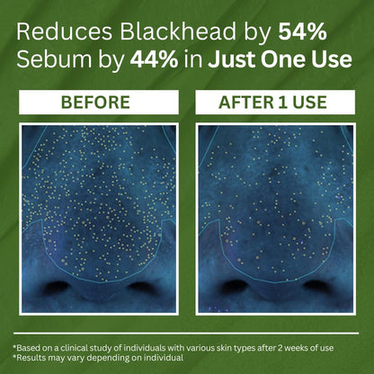 Clinclii™ Pore Bliss Bubble Mask - Deep Cleansing & Purifying