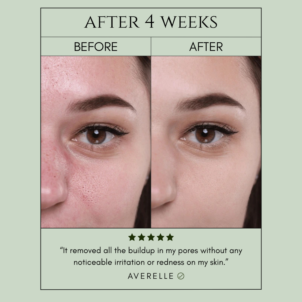 Clinclii™ Pore Bliss Bubble Mask - Deep Cleansing & Purifying